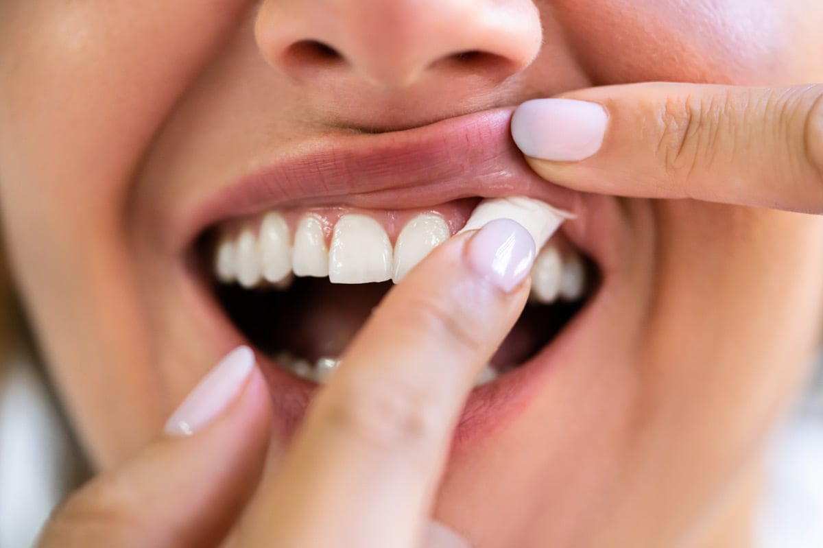 Are Nicotine Pouches Bad for Your Gums?